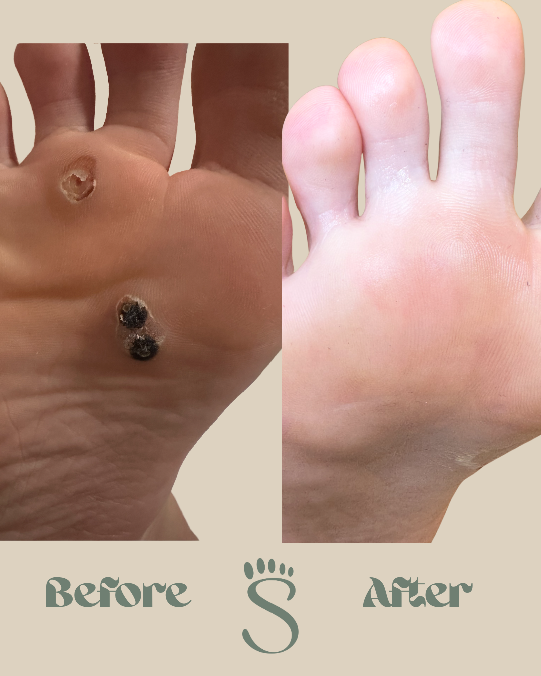 SWIFT RESULTS SYDNEY PODIATRY CO2